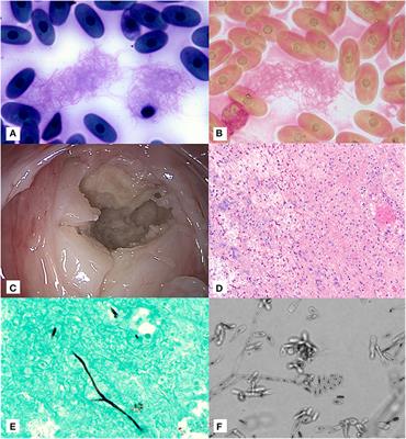 Clinical Manifestation and Molecular Characterization of a Novel Member of the Nannizziopsiaceae in a Pulmonary Granuloma From a Galapagos Tortoise (Chelonoidis nigra)